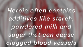 quote that says, 'heroin often contains additives like starch, powdered milk and sugar that can cause clogged blood vessels when injected'